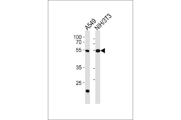 TBX4 anticorps  (N-Term)