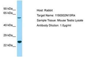 Image no. 1 for anti-Chromosome 3 Open Reading Frame 58 (C3ORF58) (AA 85-134) antibody (ABIN6749934) (C3orf58 anticorps  (AA 85-134))