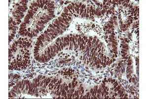 Image no. 2 for anti-Tripartite Motif Containing 38 (TRIM38) (AA 1-265) antibody (ABIN1490681) (TRIM38 anticorps  (AA 1-265))