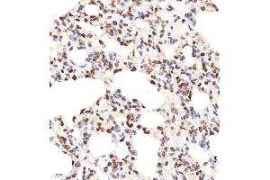 Immunohistochemistry of paraffin embedded rat lung using SHF-1 (ABIN7075710) at dilution of 1:600 (400x lens) (SHF anticorps)