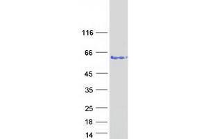 Validation with Western Blot