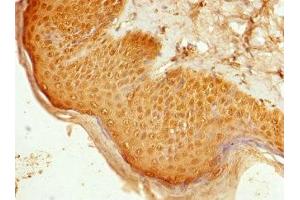 Immunohistochemistry of paraffin-embedded human skin tissue using ABIN7168788 at dilution of 1:100