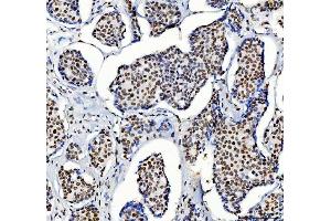 IHC analysis of HDAC2 using anti-HDAC2 antibody (ABIN7601564). (HDAC2 anticorps  (AA 387-488))
