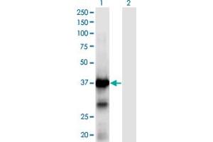Western Blot analysis of XPA expression in transfected 293T cell line by XPA monoclonal antibody (M01), clone 2E4. (XPA anticorps  (AA 1-273))