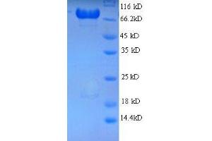SDS-PAGE (SDS) image for Adaptor-Related Protein Complex 2, mu 1 Subunit (AP2M1) (AA 1-435), (full length) protein (GST tag) (ABIN7479588)