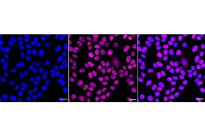 Immunocytochemical staining of HepG2 cells with MBD2 antibody (ABIN7799386), 1:1,000). (Recombinant MBD2 anticorps)