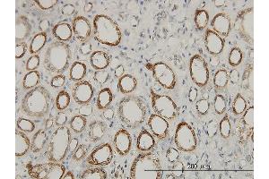 Immunoperoxidase of monoclonal antibody to ACAA2 on formalin-fixed paraffin-embedded human kidney.