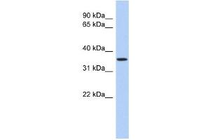POLR3F antibody used at 1 ug/ml to detect target protein.