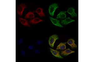 ABIN6263750 and ABIN6277026 staining Hela cells by IF/ICC.