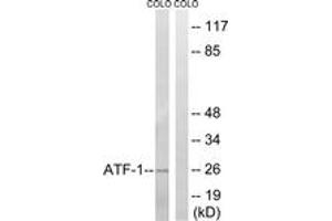 Western blot analysis of extracts from COLO cells, using ATF1 (Ab-63) Antibody. (AFT1 anticorps  (AA 31-80))