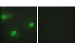 Immunofluorescence analysis of HeLa cells, using CSTF2 Antibody. (CSTF2 anticorps  (AA 11-60))