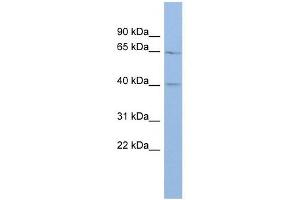 MLC1 antibody used at 1 ug/ml to detect target protein. (MLC1 anticorps  (Middle Region))