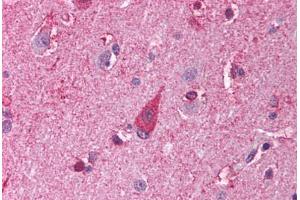 Human Brain, Cortex (formalin-fixed, paraffin-embedded) stained with TLR8 antibody ABIN214003 at 5 ug/ml followed by biotinylated goat anti-rabbit IgG secondary antibody ABIN481713, alkaline phosphatase-streptavidin and chromogen. (TLR8 anticorps)