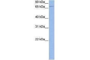 WB Suggested Anti-TBK1 Antibody Titration: 0. (TBK1 anticorps  (N-Term))
