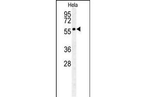 Western blot analysis in Hela cell line lysates (35ug/lane). (GALNT4 anticorps  (N-Term))