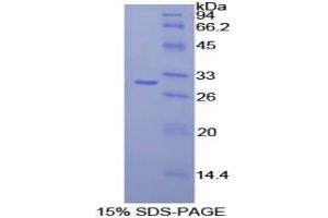 SDS-PAGE analysis of Human CELSR2 Protein. (CELSR2 Protéine)