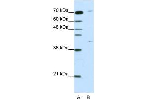 WB Suggested Anti-ZNF668 Antibody Titration:  1. (ZNF668 anticorps  (C-Term))