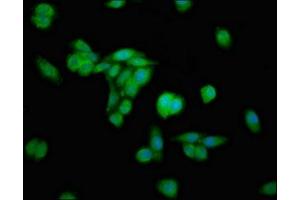 Immunofluorescence staining of HepG2 cells with ABIN7151695 at 1:100, counter-stained with DAPI. (ERGIC2 anticorps  (AA 55-310))