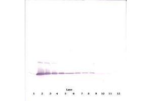 Image no. 1 for anti-Interleukin 17A (IL17A) antibody (ABIN465354) (Interleukin 17a anticorps)