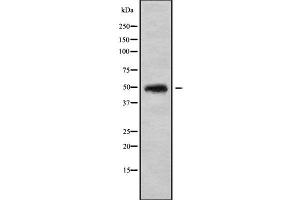 Western blot analysis of CHST5 using COLO205 whole cell lysates (CHST5 anticorps  (Internal Region))