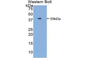 Detection of Recombinant CPB1, Human using Polyclonal Antibody to Carboxypeptidase B1, Tissue (CPB1) (CPB1 anticorps  (AA 111-417))