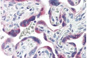 Human Placenta (formalin-fixed, paraffin-embedded) stained with CYP26A1 antibody ABIN364310 at 10 ug/ml followed by biotinylated anti-mouse IgG secondary antibody ABIN481714, alkaline phosphatase-streptavidin and chromogen.