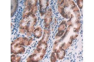 Used in DAB staining on fromalin fixed paraffin- embedded Kidney tissue