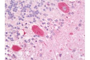 Anti-CORO1B antibody IHC staining of human brain, cerebellum.