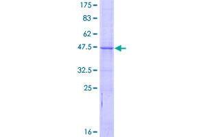 Image no. 1 for BCL2-Like 10 (Apoptosis Facilitator) (BCL2L10) (AA 1-204) protein (GST tag) (ABIN1346554)