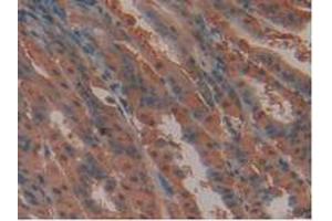 IHC-P analysis of Mouse Stomach Tissue, with DAB staining. (FLT4 anticorps  (AA 30-326))