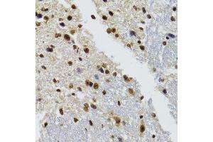 Immunohistochemistry of paraffin-embedded mouse brain using BAZ1B antibody.