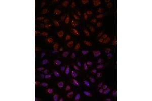 Immunofluorescence analysis of U-2 OS cells using DDX24 antibody (ABIN7266691) at dilution of 1:100. (DDX24 anticorps  (AA 510-859))