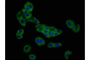 Immunofluorescence staining of HepG2 cells with ABIN7162742 at 1:166, counter-stained with DAPI. (SLC26A4 anticorps  (AA 592-655))