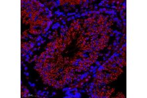 Immunofluorescence of paraffin embedded rat testis using GK2 (ABIN7074096) at dilution of 1: 500 (300x lens) (GK2 anticorps)