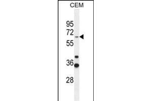 ZN Antibody (Center) (ABIN654509 and ABIN2844236) western blot analysis in CEM cell line lysates (35 μg/lane). (ZNF667 anticorps  (AA 303-331))