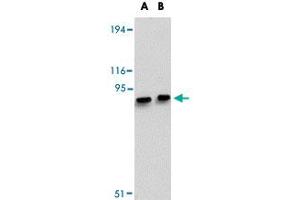 Western blot analysis of MACC1 in mouse liver tissue lysate with MACC1 polyclonal antibody  at (A) 1 and (B) 2 ug/mL . (MACC1 anticorps  (Internal Region))