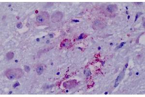 Anti-PPYR1 antibody IHC staining of human brain, hypothalamus. (NPY4R anticorps  (Cytoplasmic Domain))