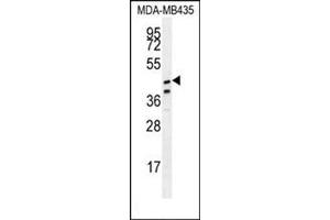 Western blot analysis in MDA-MB435 cell line lysates (35 µg/lane) using SAMD7 Antibody (Center) Cat. (SAMD7 anticorps  (Middle Region))