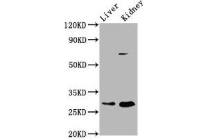 Western Blot Positive WB detected in: Rat liver tissue, Rat kidney tissue All lanes: PEX11A antibody at 2. (PEX11A anticorps  (AA 106-219))