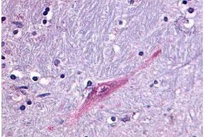 Immunohistochemical (Formalin/PFA-fixed paraffin-embedded sections) staining in human brain, putamen with GPR55 polyclonal antibody . (GPR55 anticorps  (C-Term))