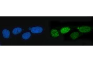 IF analysis of TIGD1 using anti-TIGD1 antibody (ABIN7602407).