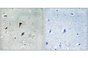 Immunohistochemical analysis of paraffin-embedded human brain tissue using MAP2K3 (Phospho-Thr222) antibody (left)or the same antibody preincubated with blocking peptide (right).