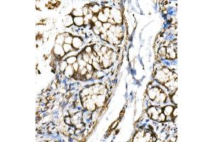 Immunohistochemistry of paraffin-embedded rat colon using BHLHE40 Rabbit pAb (ABIN6129354, ABIN6137550, ABIN6137551 and ABIN6222195) at dilution of 1:150 (40x lens). (BHLHE40 anticorps  (AA 173-412))
