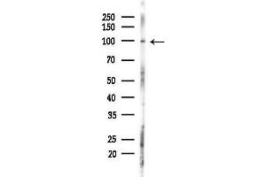 anti-Eukaryotic Translation Initiation Factor 2C3 (EIF2C3) (Internal Region) antibody