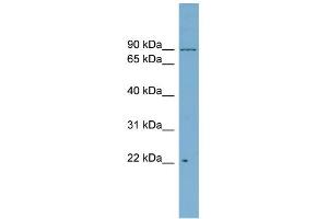 WB Suggested Anti-C12orf11 Antibody Titration: 0. (C12orf11 anticorps  (Middle Region))
