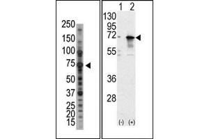 Image no. 1 for anti-Protein Inhibitor of Activated STAT, 1 (PIAS1) (N-Term) antibody (ABIN5552003) (PIAS1 anticorps  (N-Term))