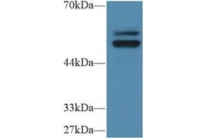 Western Blot; Sample: Human HL60 cell lysate; Primary Ab: 1µg/ml Rabbit Anti-Human PTPN5 Antibody Second Ab: 0. (PTPN5 anticorps  (AA 331-558))
