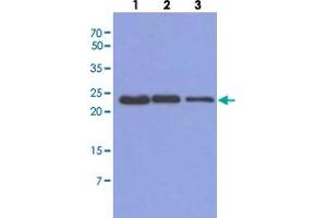 Western blot analysis of Mouse muscle extract (40 ug) by using TNNI1 monoclonal antibody, clone AT36E7  (1:500-1:5000). (TNNI1 anticorps  (AA 1-187))