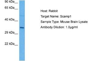 Host: Rabbit Target Name: SCAMP1 Sample Tissue: Mouse Brain Antibody Dilution: 1ug/ml (SCAMP1 anticorps  (N-Term))