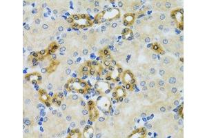 Immunohistochemistry of paraffin-embedded Mouse kidney using PHPT1 Polyclonal Antibody at dilution of 1:100 (40x lens).